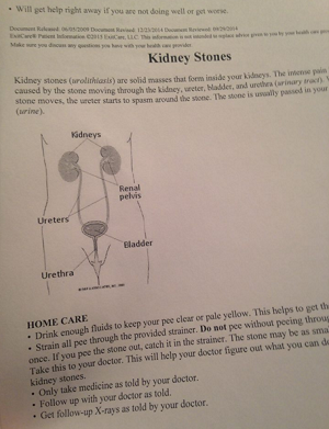 This is a diagram of the kidneys of a human.